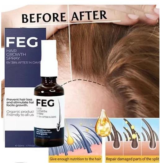 FEG Hair Growth Spray Serum – Anti-Hair Loss Treatment - 14 Days Booster 50ml