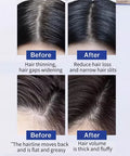 FEG Hair Growth Spray Serum – Anti-Hair Loss Treatment - 14 Days Booster 50ml