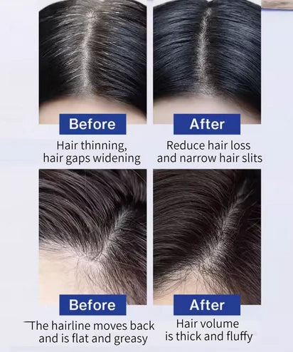 FEG Hair Growth Spray Serum – Anti-Hair Loss Treatment - 14 Days Booster 50ml
